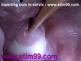 Insertion Semen Cum here Cervix Wide Stretching Pussy Speculum